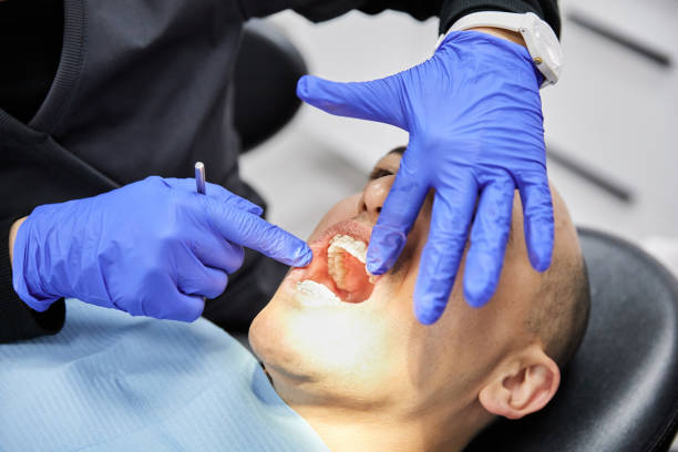 Best Emergency Dental Care for Broken or Chipped Teeth in Shamokin Dam, PA